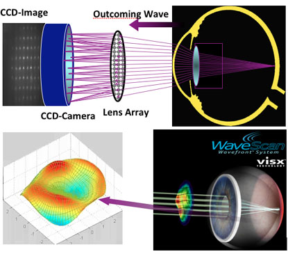 前導波像差儀檢查 (WaveScan)