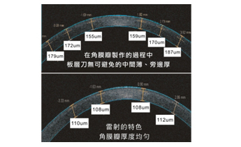 第五代IntraLase飛秒雷射(iFS 150)特點