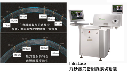 第五代IntraLase飛秒雷射(iFS 150)特點